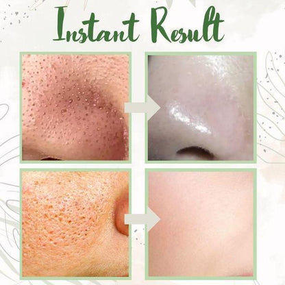 🎁Limited time discount 🔥 last day 💥AQA™ Green Tea Deep Cleanse Mask Stick