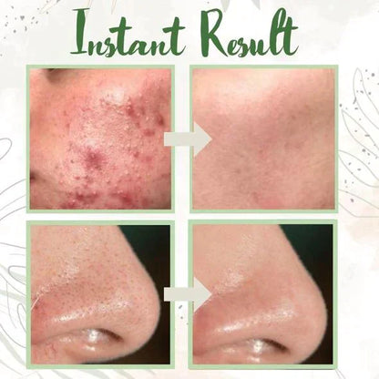 🎁Limited time discount 🔥 last day 💥AQA™ Green Tea Deep Cleanse Mask Stick