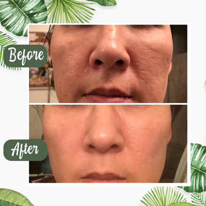 🎁Limited time discount 🔥 last day 💥AQA™ Green Tea Deep Cleanse Mask Stick