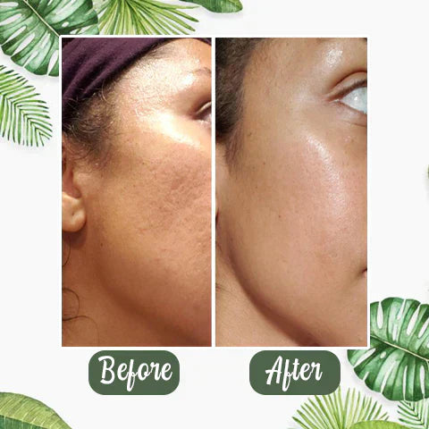 🎁Limited time discount 🔥 last day 💥AQA™ Green Tea Deep Cleanse Mask Stick
