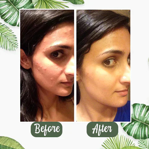 🎁Limited time discount 🔥 last day 💥AQA™ Green Tea Deep Cleanse Mask Stick